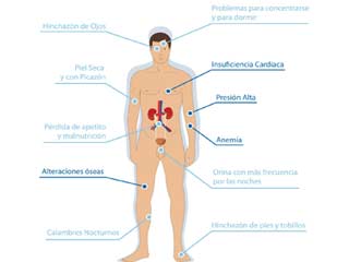 Prevé la Insuficiencia Renal fifu