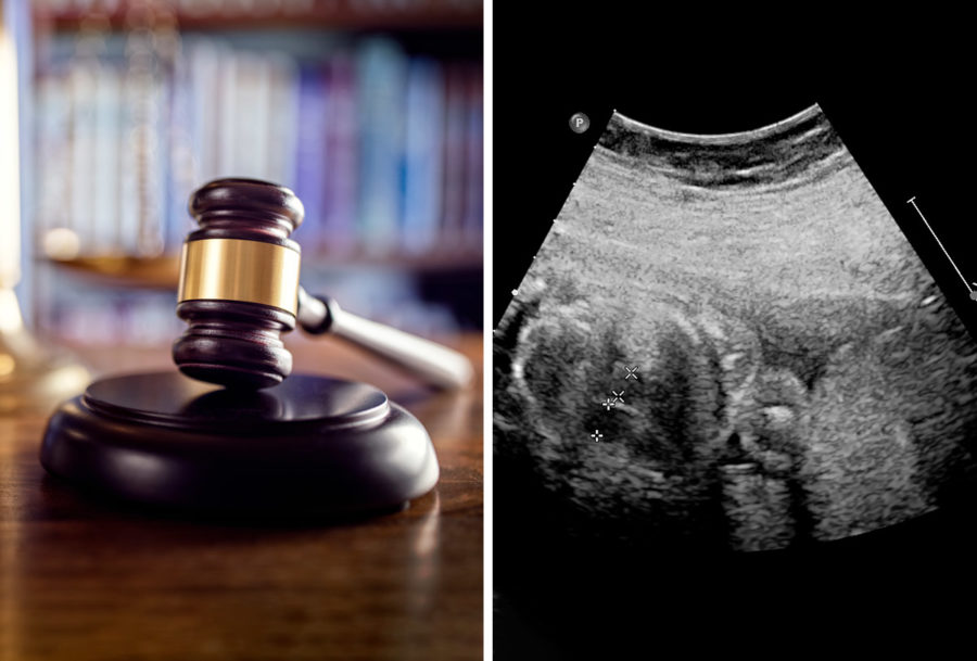 Suprema Corte de justicia y aborto